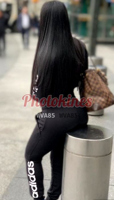 Mireya 992380638 - Kinesióloga en Lince