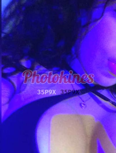 Valentina 928768480, Kinesióloga en Lince
